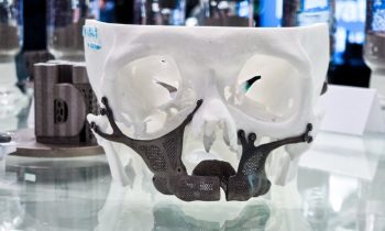 Beispiel einer Legierung, bestehend aus Titan, Niobium und Tantal, in einem CMF-Implantat (Bild: Tanobis).